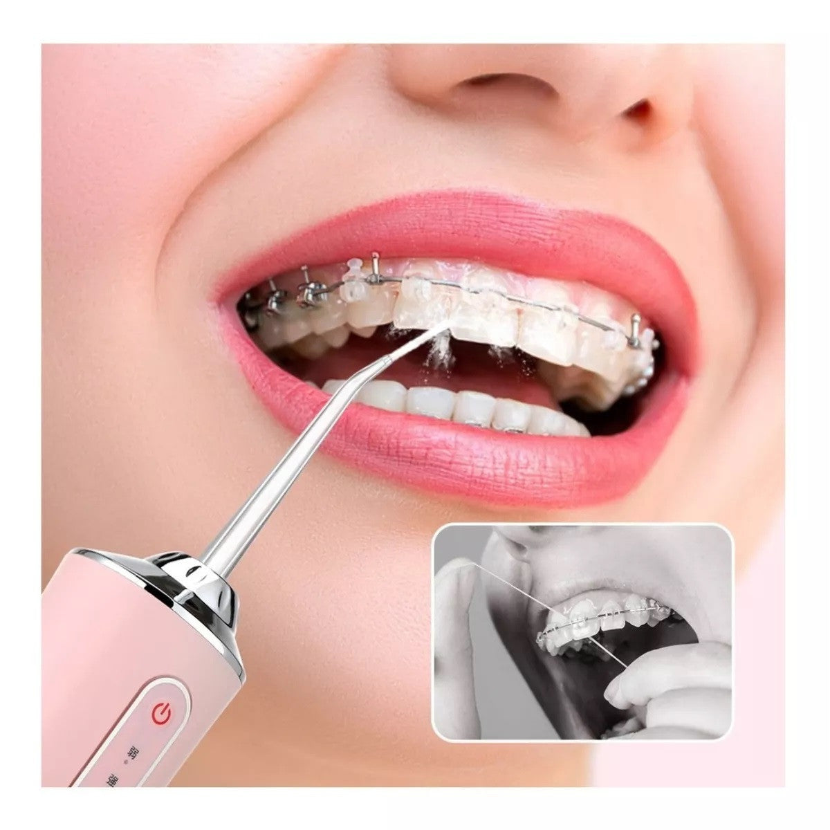 Irrigador Oral Recargable + Envío gratis + Atención 24 horas (3502341167)