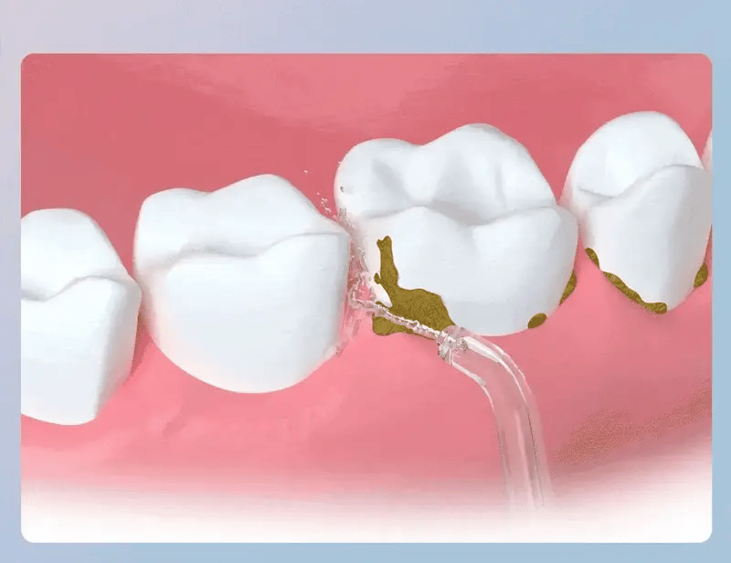 Irrigador Oral Recargable + Envío gratis + Atención 24 horas (3502341167)