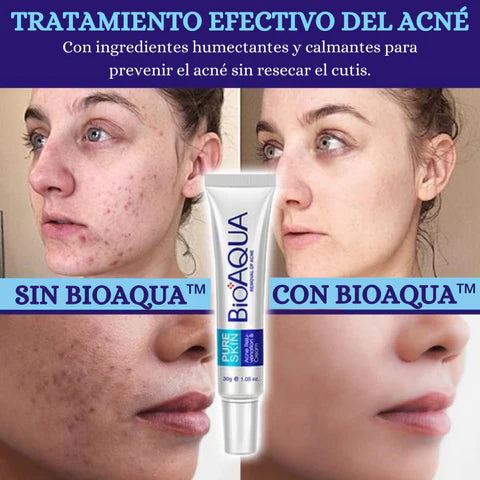 CREMA ANTI-ACNÉ Y ESPINILLAS DE BIOAQUA