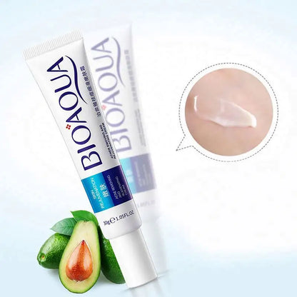 CREMA ANTI-ACNÉ Y ESPINILLAS DE BIOAQUA